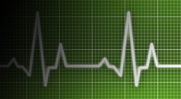 Animated ECG Rhythms Course