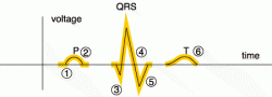 P QRS T labeling designation on ECG rhythm