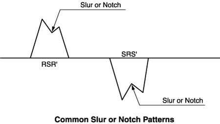 12-lead ECG RSR' Slur or Notch Patterns