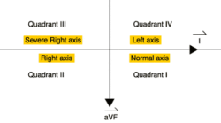12-lead Axis Quadrants