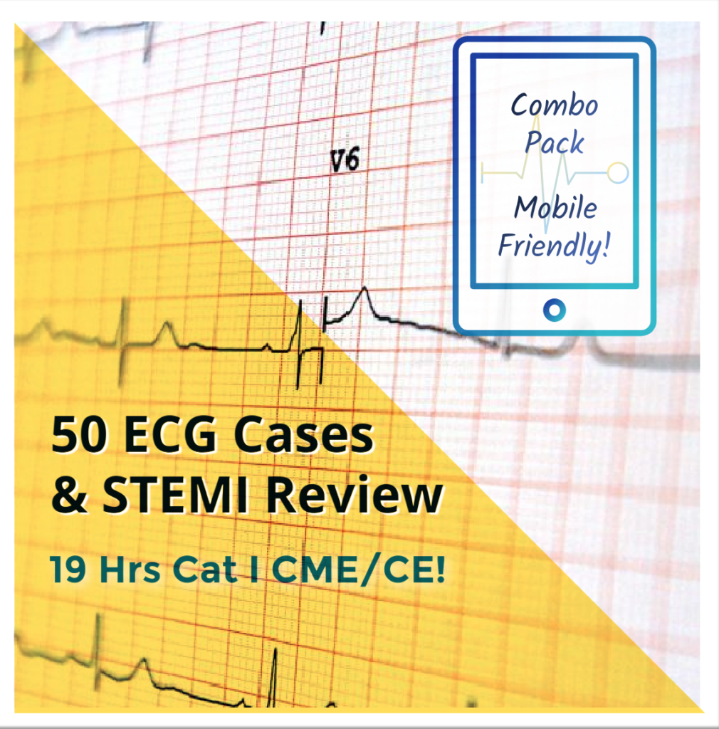 EKG Case Study, STEMI Interpretation