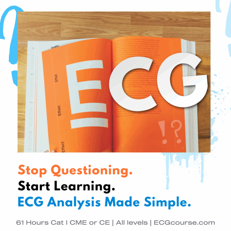 Free Ecg Quiz 12 Lead Ecg Rhythms Training Template
